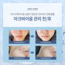 아크솔루션