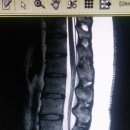 허리디스크MRI 와 목 CT 문의입니다 ! 이미지