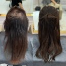 만모헤어 | 가발을 벗고 싶었던 30대 직장인 여성의 변화, 발모벽 고객 맞춤 증모술 8시간 프로젝트
