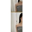 창원 에스테틱 끌리메 끌링 10회차 앞 볼륨, 긴 얼굴, 사이즈 개선된 솔직후기