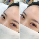 클라라뷰티라인 이미지