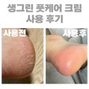 풋크림 추천 생그린 풋케어 풋크림 사용 전후 변화