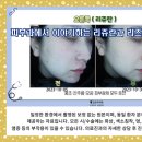 리즈의원 앞 이미지