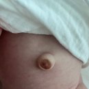 분홍빛으로병원 | 신생아 아기 배꼽 튀어나옴 원인 탈장 병원 | 아기 도장 내돈내산 후기