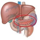 인슐린 의존성 당뇨병(Insulin-dependent diabetes mellitus) 이미지