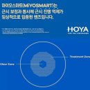 눈에존안경 이미지