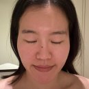 마곡747타워(마곡역교차로) | 마곡 피부관리 선에스테스파 마곡점 울트라V업 신부관리 2회차 후기