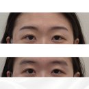 [ 구리 눈썹문신 재방문 리뷰 ] "코 골고 잘 정도로 편안한 시술" 눈썹명가 리얼 후기 ✨