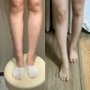 유라인 - 강릉시 사임당로 129 | 강남 지방분해주사 후기 강남 다이어트병원 유라인클리닉 리뷰