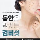 미엘피부과 네이버블로그