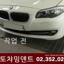 오토덴트칼라 이미지