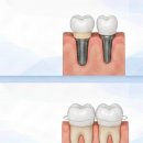 이라인치과기공소 이미지