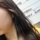 수지구청역 인모드 리프팅 FX+ 인모드 FORMA , 수지구청피부과, 밴스의원 추천, 수지 인모드 솔직후기,