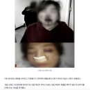 &#34;강아지 배변했으니 치워달라&#34; 했다가 주먹 날아와 &#39;코 뼈 골절&#39; 이미지