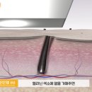 리마인드피부과의원 이미지