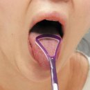 혀 클리너로 설태 제거하면 구강 내 세균 75％ 줄어|| 이미지