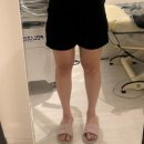 류라인의원 | 바지 사이즈 바뀌는 류의원 지방분해주사 비포&amp;애프터