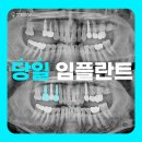 치아발전소치과의원 이미지
