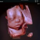 전인병원 | [임신 29주] 시온여성병원 입체초음파, 베이비페이스 후기👶🏻