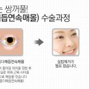 닥터비의원 네이버블로그
