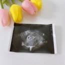 정성일산부인과의원 네이버블로그