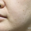 크로스메드 이미지