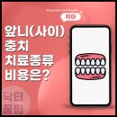 벤처세라믹치과기공소 | 용인 치과 앞니 사이 충치 초기 증상부터 레진 치료 비용 통증까지 정리