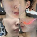 채움약국 | 물만골 피부관리 채움뷰티 노하우가 담긴 에스테틱 대만족 방문후기