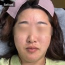 더조은메디컬 | [원주] 혁신도시 왁싱 잘하는 곳, &#34;뷰티아이콘&#34; 인중왁싱, 눈썹왁싱 후기