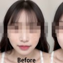C-SKIN 이미지