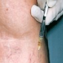 아나파적맥통증의원 이미지