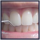 부천청담네오플란트치과의원 이미지