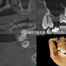 청주으뜸치과의원 이미지