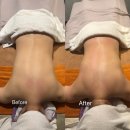 뷰티 몽 | 청담역 마사지 청담 에스테틱 뷰티블르바드 상체관리 후기