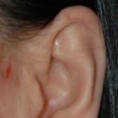 에버성형외과의원 이미지