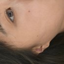 이마트24 외대이문점 | 외대문제성피부 <노메러스킨> 리커버리케어 이문피부관리