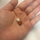 분당서울대학교병원 노동조합 | 임신중기기록&gt; 쌍둥이 임신 29-30주 증상 총정리 + 분당 서울대 병원 수술 날짜 확정 + 백일해 주사