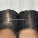 핫보이&핫걸 뷰티아카데미 | [서울 성수] 올라뷰티샵 가르마 시술 후기, 내돈내산 지인할인 정보