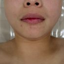 포항빌딩 | 포항 두호동에스테틱 새미모에서 하이푸리프팅 윤곽관리 후기