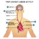 세동 티스토리