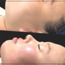 에그뮤즈 스킨스칼프 이미지