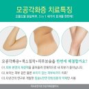 착한모공 이미지