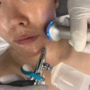 미사모공세척 고원장의 모공세척 테라피 미사점, 초음파 수분채움 리프팅 관리후기