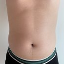 강남라인한의원 | 강남라인한의원 [복부비만 일주일 벼락치기 다이어트] 찐 후기