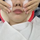 인뷰티(INBEAUTY) | 수원 정자동피부샵 “인뷰티” : 라라필 후기