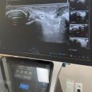 청담리온정형외과의원 | [청담정형외과]발목 전거비인대파열/인대늘어났을 때 찾은 족부전문 청담 리온정형외과 방문 솔직 후기