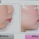 서울고운미소치과교정과치과의원 이미지
