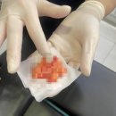 박종태유바외과의원 | ○ 한티역 박종태유바외과. 지방종 제거 후기. 드디어 묵은 고민 해결😏