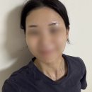 청솔헤어라인 - 김해시 | 대구 황금동 왁싱 잘하는곳 소온바디앤왁싱 헤어라인 후기