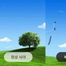 눈 비문증 원인 진단 눈에아지랑이 날파리증 이미지